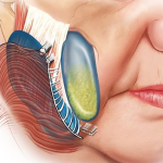 Спейслифтинг от доктора Росса