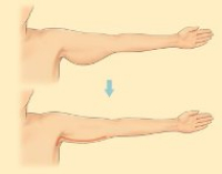 До и после брахиопластики