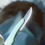 Брестский «хирург» прокомментировал свою неудачную операцию