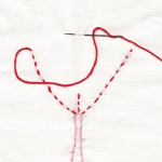 Женщины делают это: интимная пластика