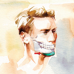 Эндопротезы для подбородка