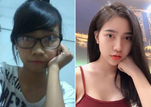 Тран Ву Ван Ань до и после пластических операций