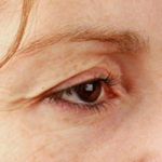 Вокруг орбиты: возможности круговой блефаропластики