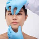 Этническая ринопластика