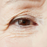 Опущение век