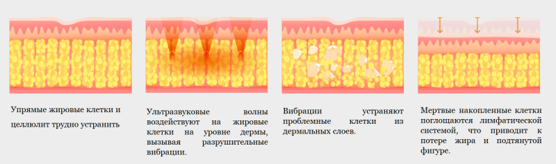 Как работает процедура Ульфит