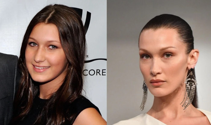 Белла Хадид до и после ринопластики
