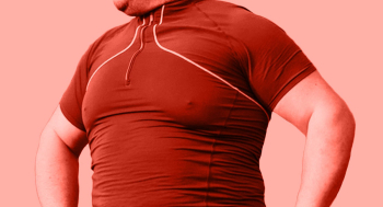 Как бороться с гинекомастией: удаление «мужской груди»