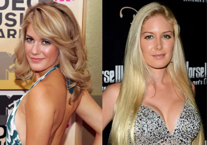 Хайди Монтаг до и после пластических операций