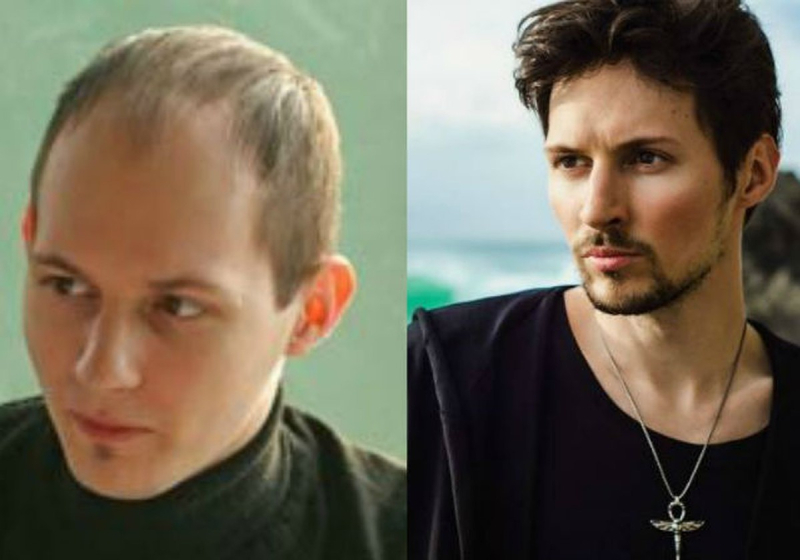 Павел Дуров до и после пересадки волос