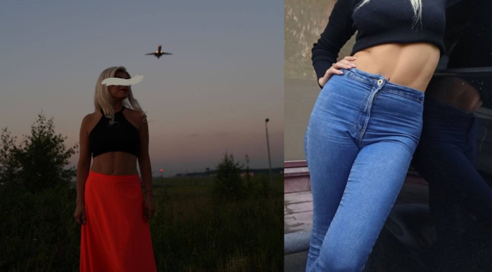 Пациентка пластического хирурга Карена Пайтяна до и после абдоминопластики с переносом пупка и с липосакцией живота и боков