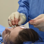 Некроз кожи после подтяжки лица