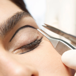 5 вещей, которые нужно знать о блефаропластике