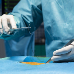 Главные хитрости наложения швов после пластической операции