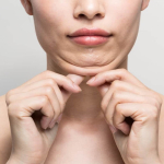 Что лучше: липолитики или липосакция подбородка?