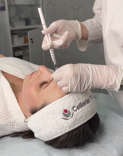 Процедура ботулинотерапии в клинике NBC