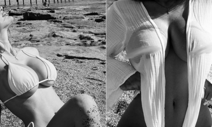 Пациентка пластического хирурга Гукаса Миракяна после увеличения груди имплантами. Фотоотзыв