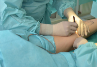 Круропластика у Валерия Стайсупова