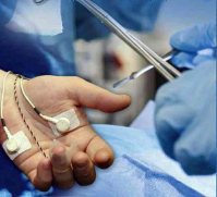 Хирургия кисти