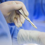 Поклонница Кардашьян умерла после увеличения ягодиц