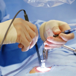 В Петербурге проведут уникальную операцию бесполому ребенку