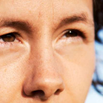 В Ташкенте блефаропластику пациентке сделал стоматолог