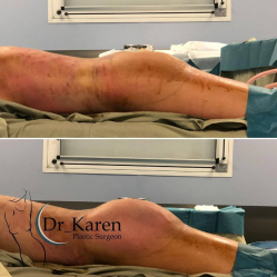 Пациентк доктора Карена Пайтяна