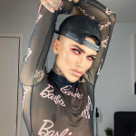 Британец сделал пластику лица как на фильтре Instagram