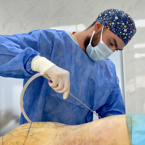 Пластический хирург Амрам Пайтян выполняет липосакцию