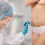 Липосакция оказалась самой популярной пластической операцией в мире