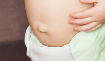 Пупочная грыжа