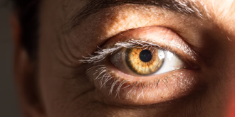 Как убрать мешки под глазами