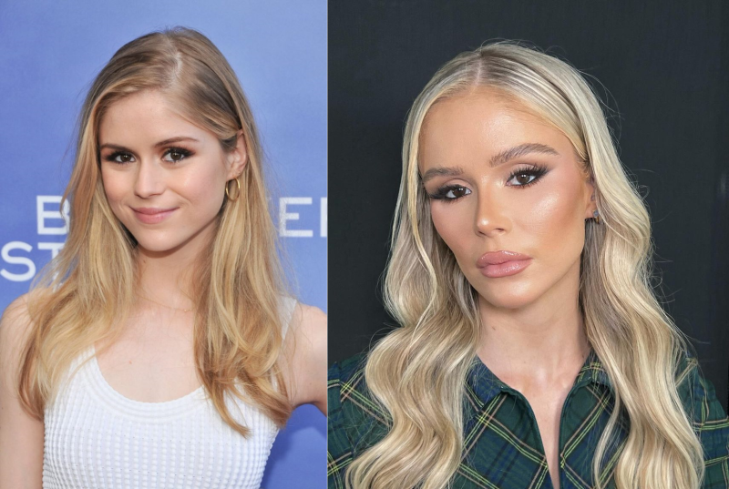 Эрин Мориарти до и после пластической операции