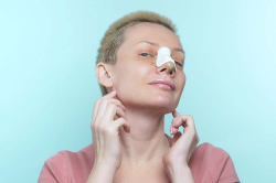 Хронология стадий отека после ринопластики