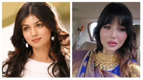 Звезда Болливуда покинула соцсети после травли из-за пластической операции